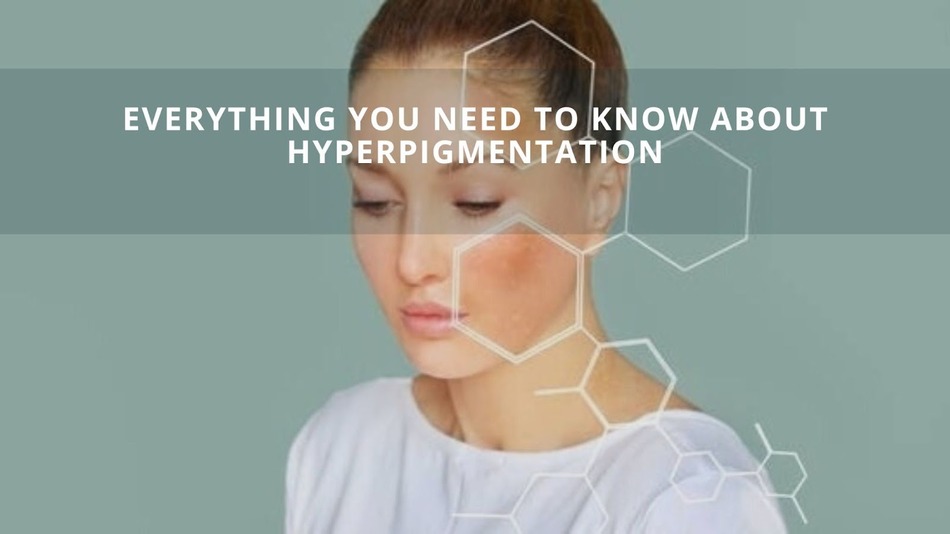 Everything You Need To Know About Hyperpigmentation