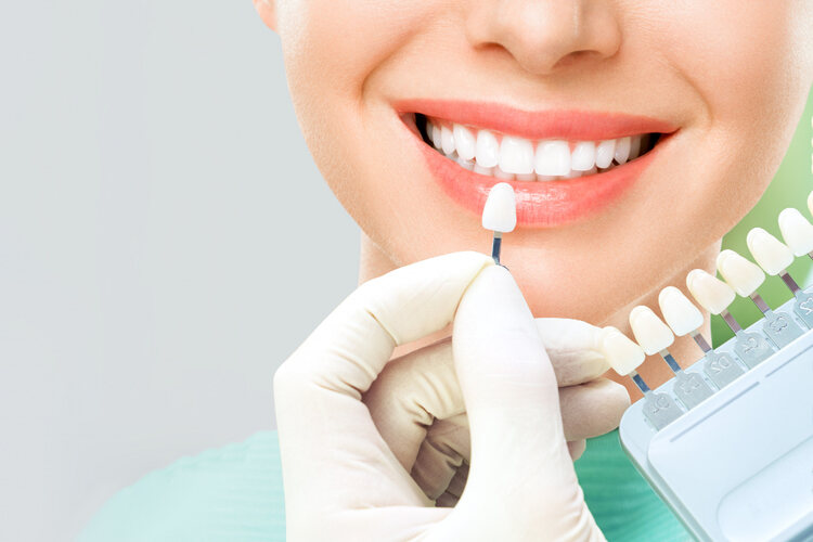 15 Common Teeth Whitening Myths Debunked